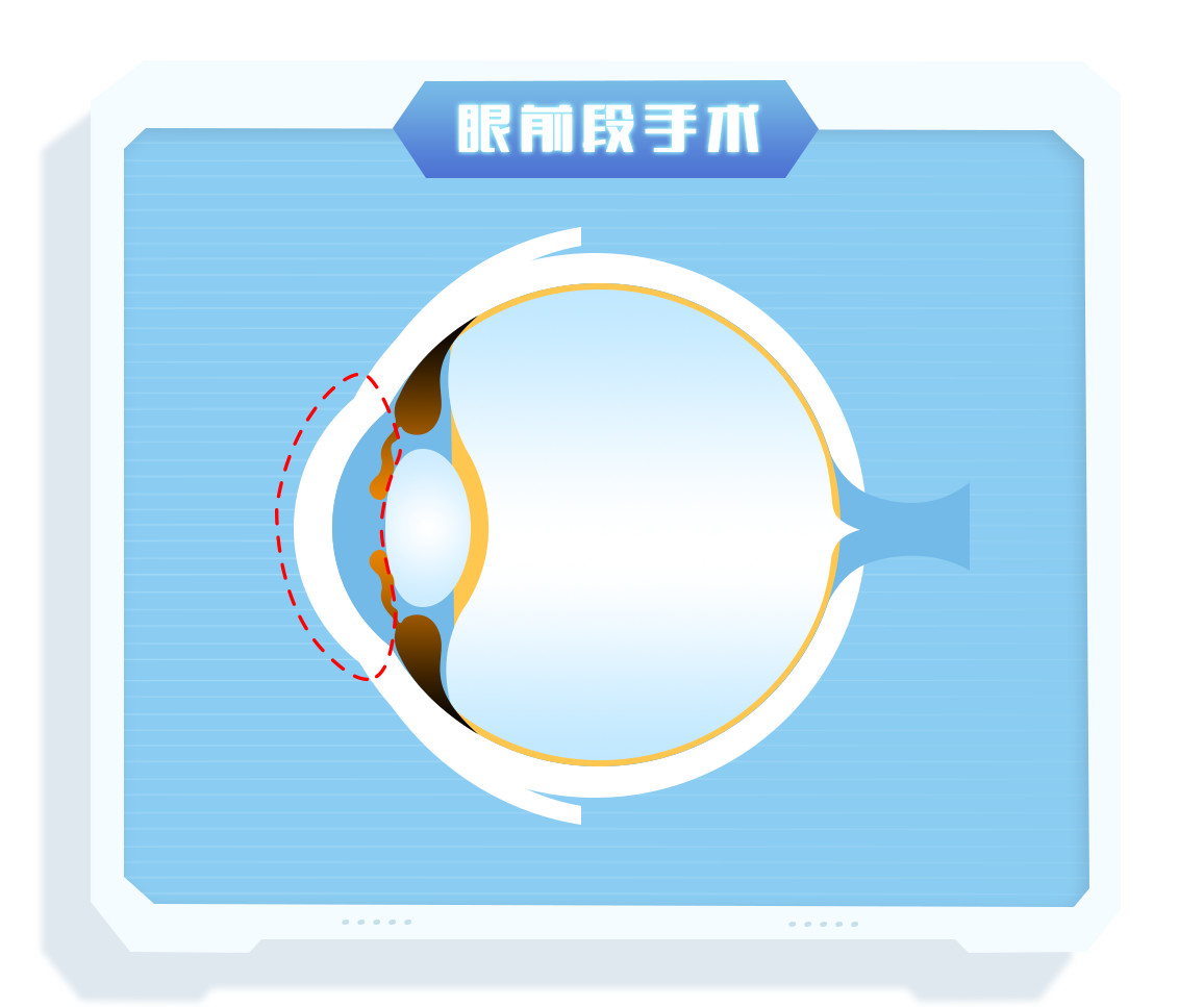 edb628f4728bf23e3212605c598b61eb